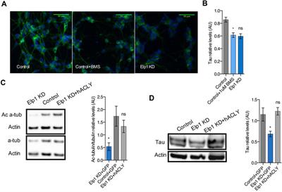 Elongator promotes neuritogenesis via regulation of tau stability through acly activity